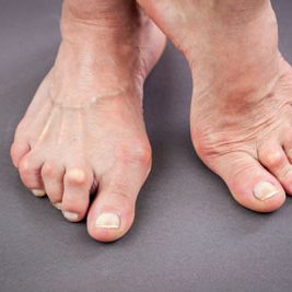 Bay Area Podiatry Center – Advanced Specialists in Foot and Ankle Care