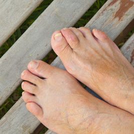 Plantar Fasciitis • Conway Podiatrist